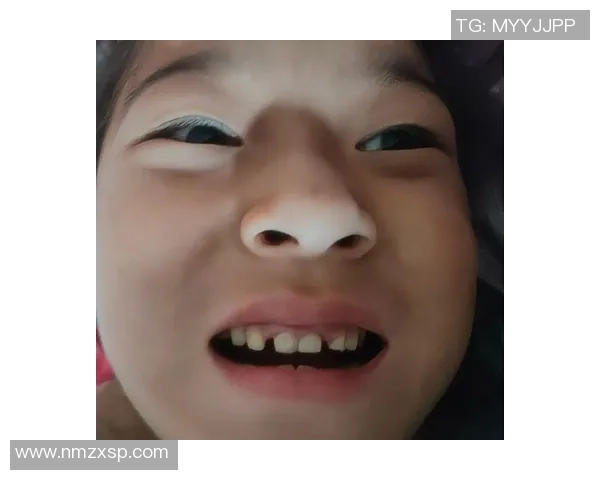 足球球星换牙事件揭秘 从牙齿到笑容的背后故事 足球球星换牙事件揭秘 从牙齿到笑容的背后故事